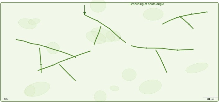 Potassium hydroxide mount of a skin scraping: long branching septate hyphae running across a cleared field with faint residual keratinocyte outlines.