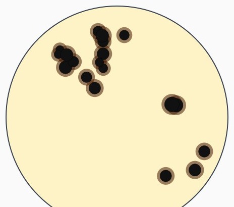 Agar plate after 48 hours of anaerobic incubation: discrete black colonies, each ringed by a brown-black diffuse zone in the surrounding pale medium.